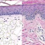 How Cancerous FFPE Slides Are Transforming Diagnostic Pathology