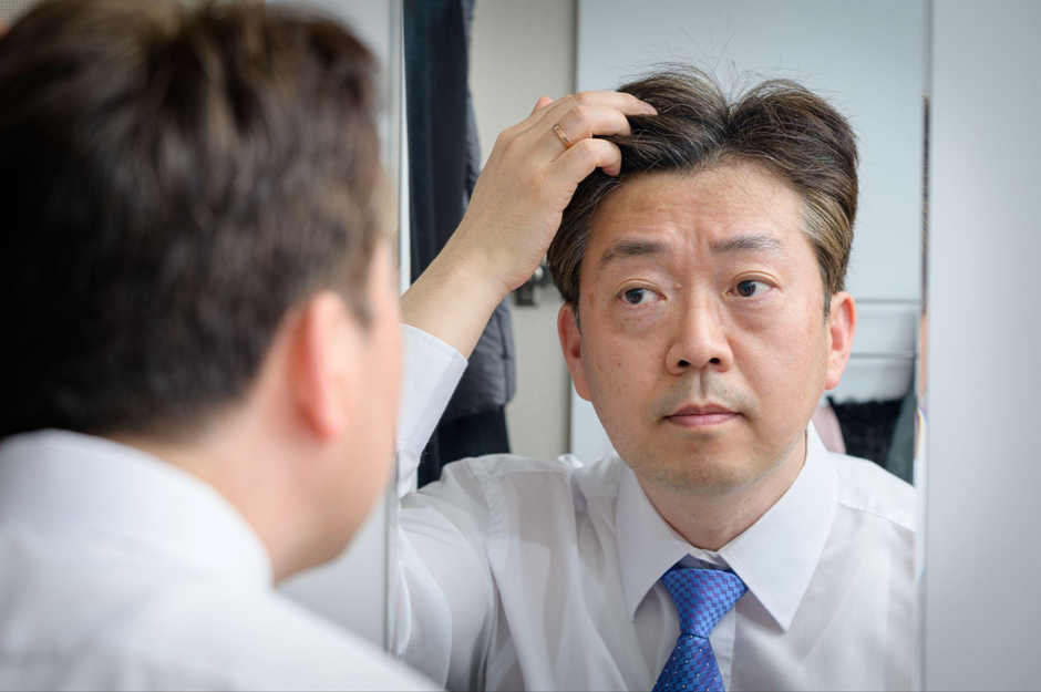 Hair Transplant