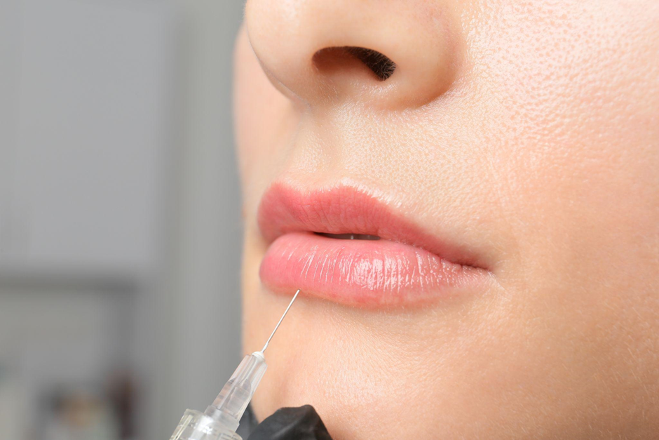 Lip Filler Aftercare Long-Term