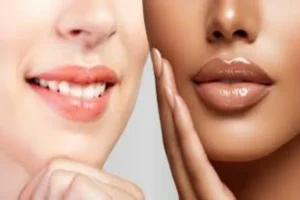 Natural Lip Filler: Enhancing Your Beauty with Subtle Elegance