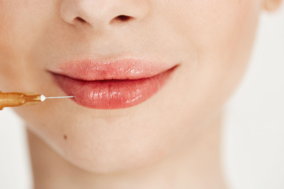 Lip Filler Aftercare Long-Term