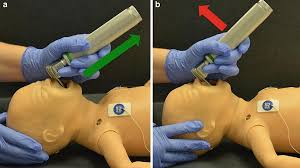 Different Methods Adopted by Medical Experts to Manage Neonatal Airway Care