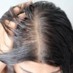 What an Oily Scalp Actually Wants From a Treatment Routine 