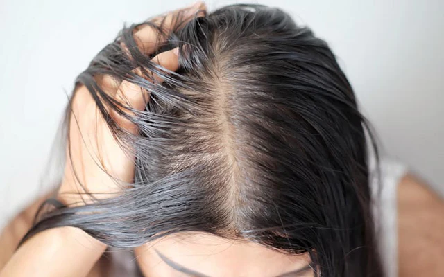 What an Oily Scalp Actually Wants From a Treatment Routine 
